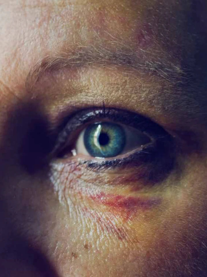 Close-up of a person's eye with visible blue irises and brown skin texture.
